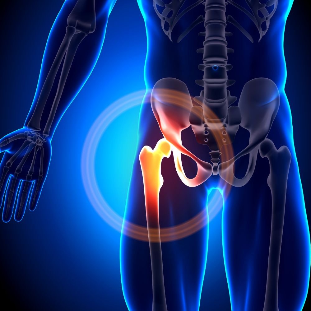 Hip Replacement Surgery